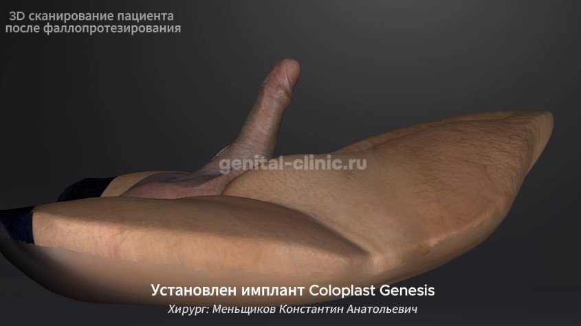 видео genesis