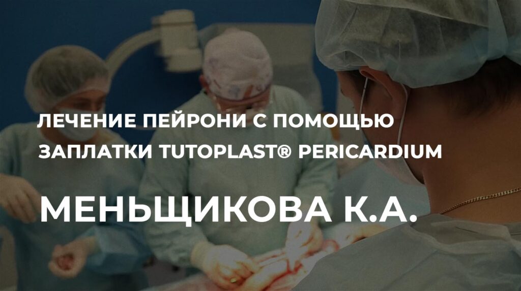 Графтинг