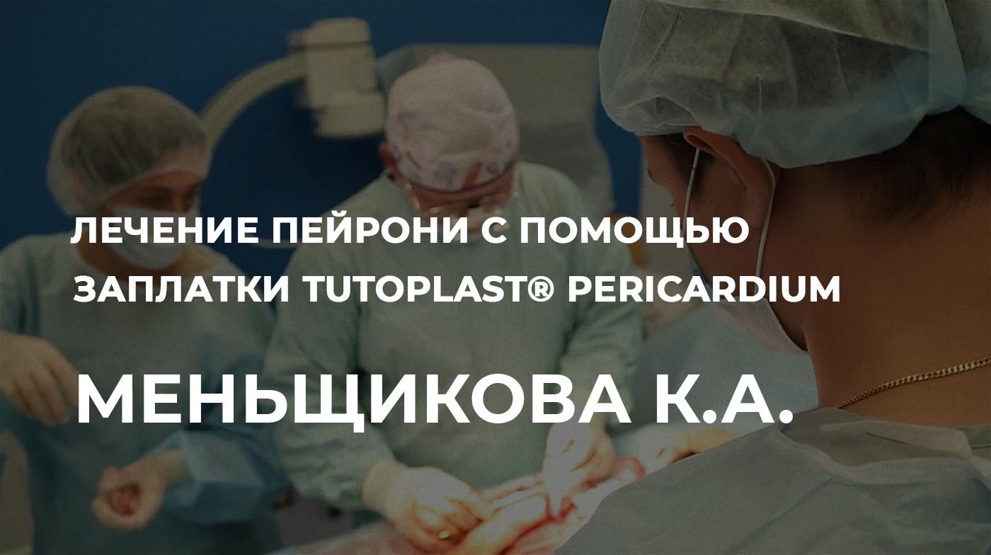 Графтинг