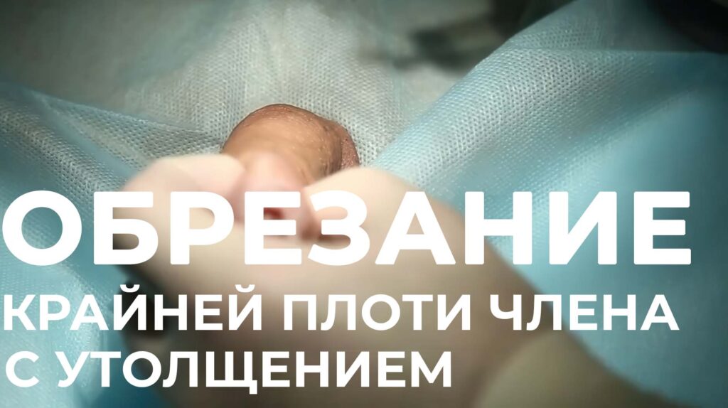 видео обрезание
