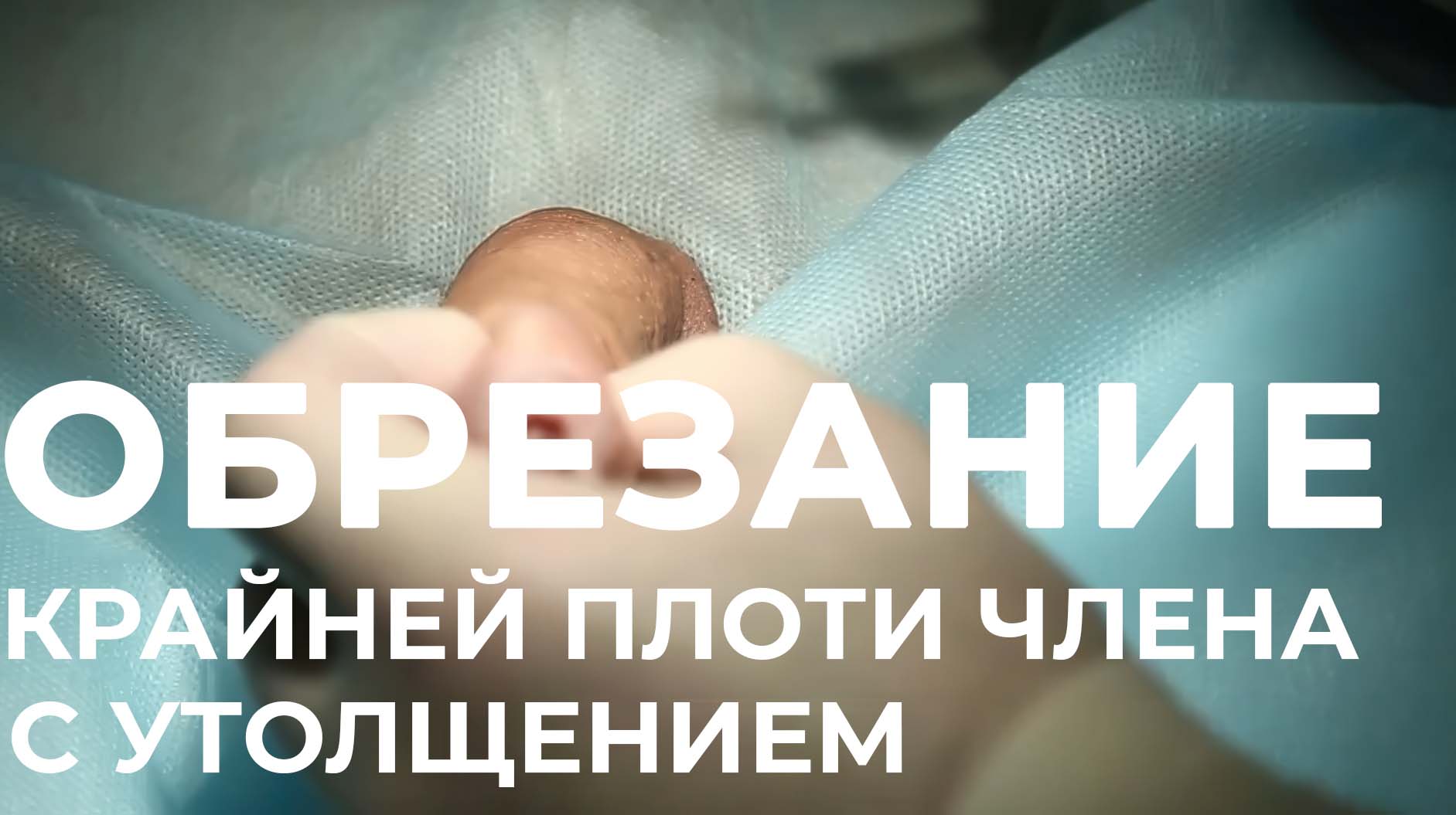 видео обрезание