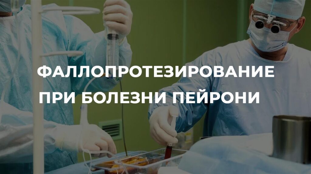 Фаллопротезирование при болезни Пейрони