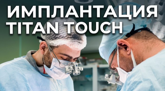 установка протеза титан тач
